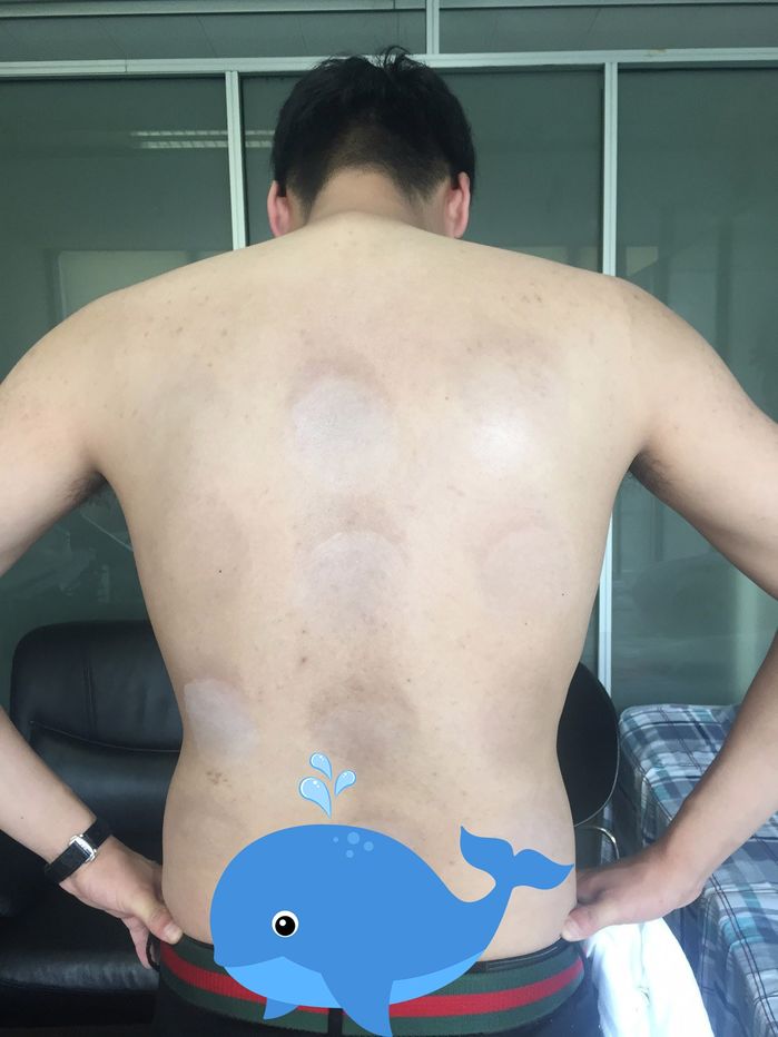 Chàng trai liều mình thử nghiệm hiệu quả 12 loại kem chống nắng
