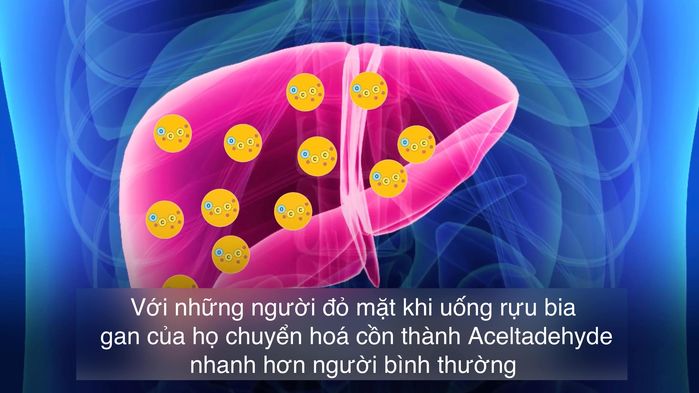 Đỏ mặt khi uống rượu bia - dấu hiệu của triệu chứng nguy hiểm!