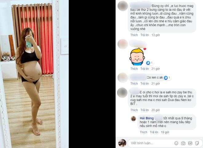 Hải Băng: Tăng 13kg, đi không nổi vì vết mổ cũ bị đau”