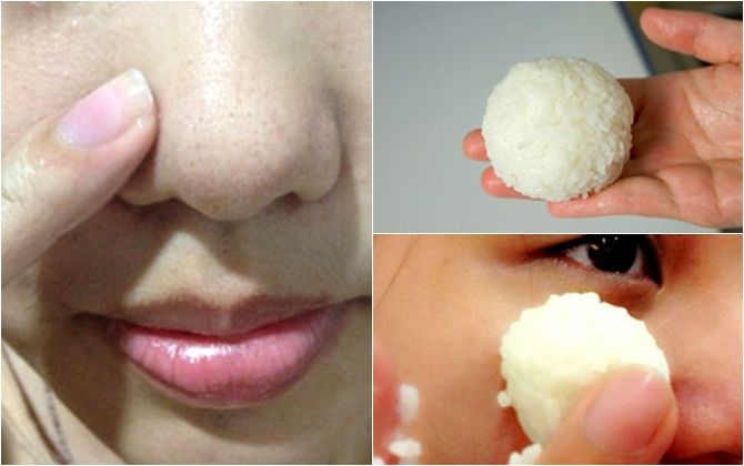 Trị mụn đầu đen tại nhà với nguyên liệu thiên nhiên