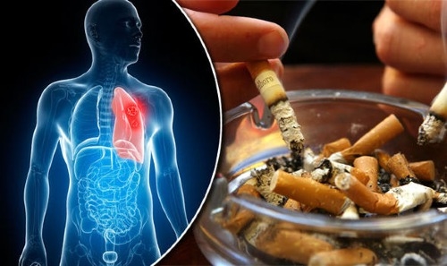 Nghệ sĩ Lê Bình qua đời vì ung thư phổi, di căn tới tủy