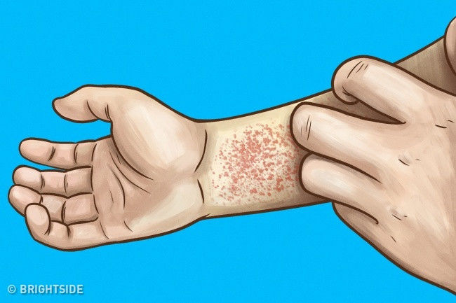 Những dấu hiệu cảnh báo thận của bạn đang có vấn đề