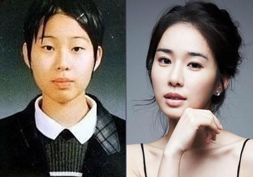 Park Min Young dẫn đầu danh sách siêu phẩm dao kéo châu Á