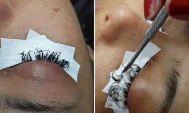 Rợn người với những hình ảnh nối mi hỏng: Bạn còn dám đi nối mi không?