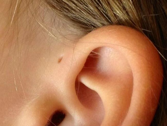 Những đặc điểm trên cơ thể chưng mình bạn là người cực hiếm