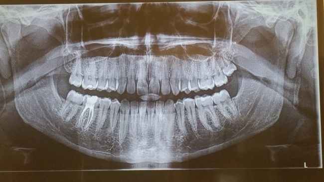 Những đặc điểm trên cơ thể chưng mình bạn là người cực hiếm