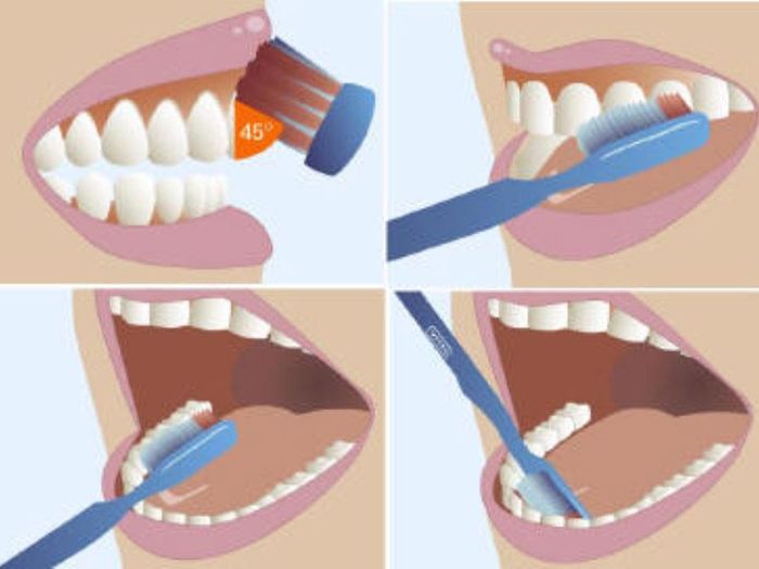 Chăm sóc răng miệng đúng cách
