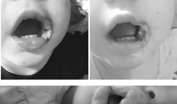 Cảnh báo em bé bị điện giật vì ngậm đầu dây sạc điện thoại