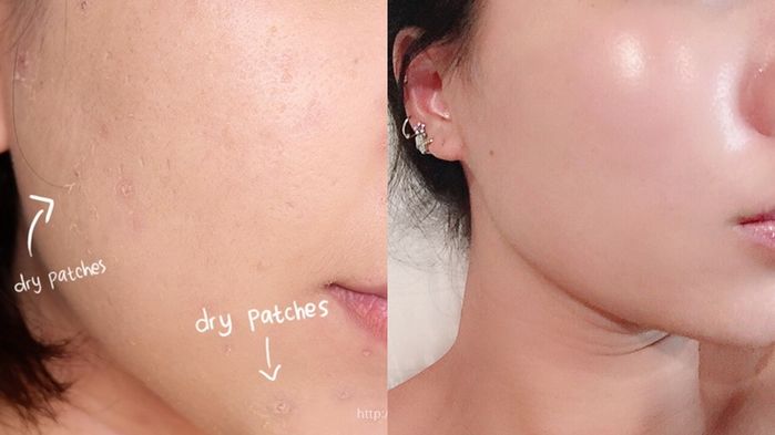 Lỗ chân lông từ từ khép lại nhờ skincare đúng cách