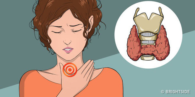 Mắc bệnh cường giáp, Trúc Diễm sa sút sức khỏe mặt đơ, mắt lồi