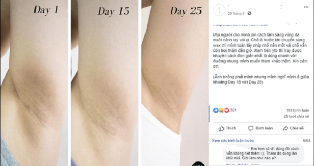 Cách điều trị thâm nách với nguyên liệu dễ tìm