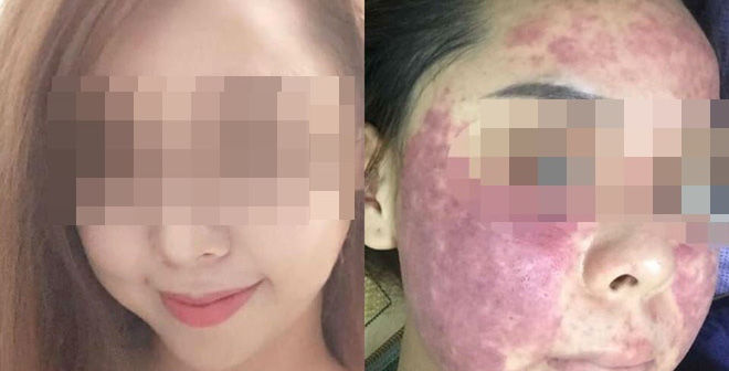Hãi hùng trước những tác hại do kem trộn thần tốc mang lại