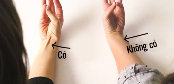 Những đặc điểm trên cơ thể chưng mình bạn là người cực hiếm