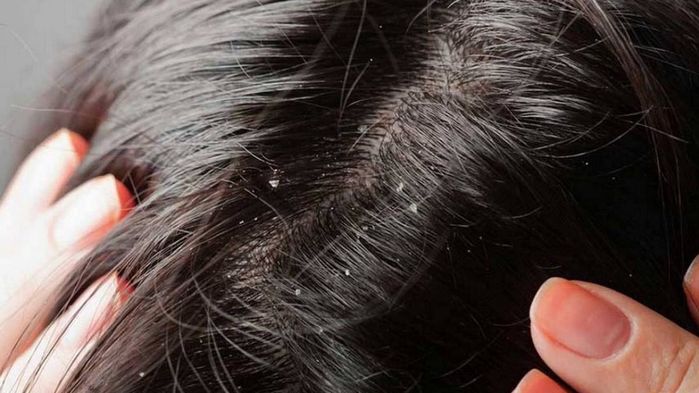 Tóc - nhà tiên tri cho sức khỏe của bạn