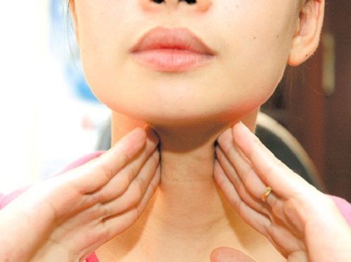 Mắc bệnh cường giáp, Trúc Diễm sa sút sức khỏe mặt đơ, mắt lồi