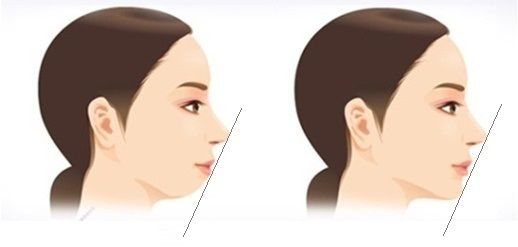 Xem tướng cằm có thể đoán biết ngay số mệnh giàu nghèo của một người