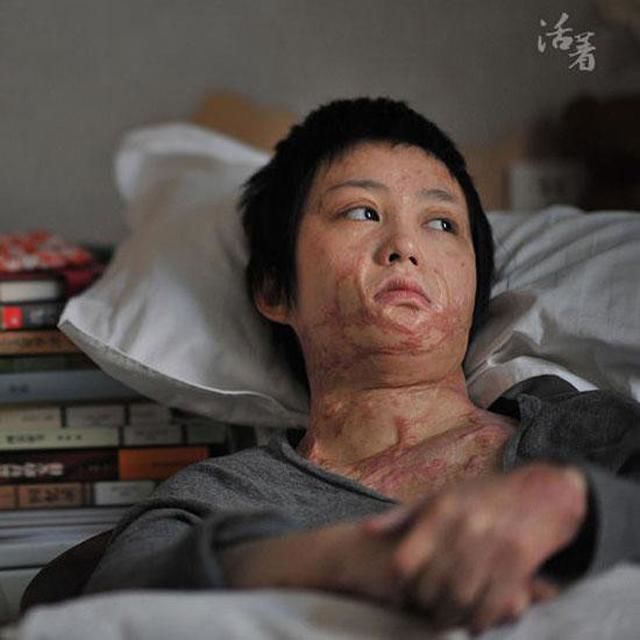 Cô gái bị thiêu sống năm 16 tuổi vì từ chối tình cảm của thiếu gia