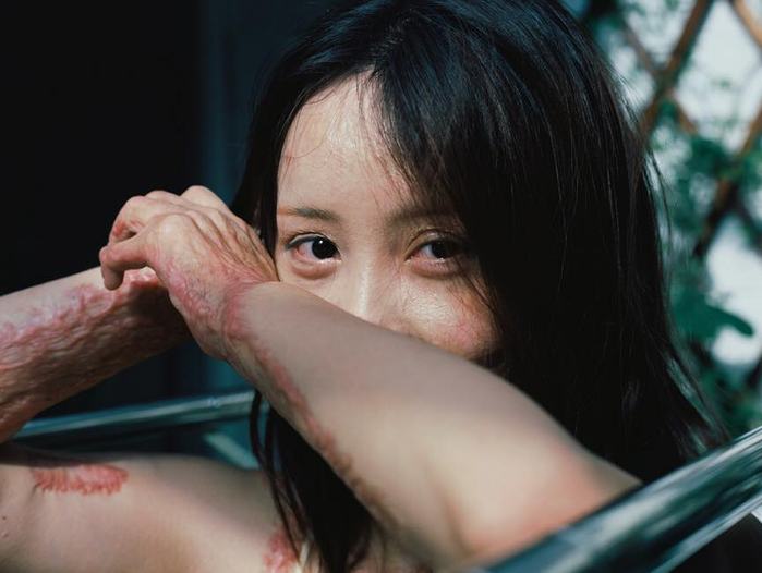 Cô gái bị thiêu sống năm 16 tuổi vì từ chối tình cảm của thiếu gia