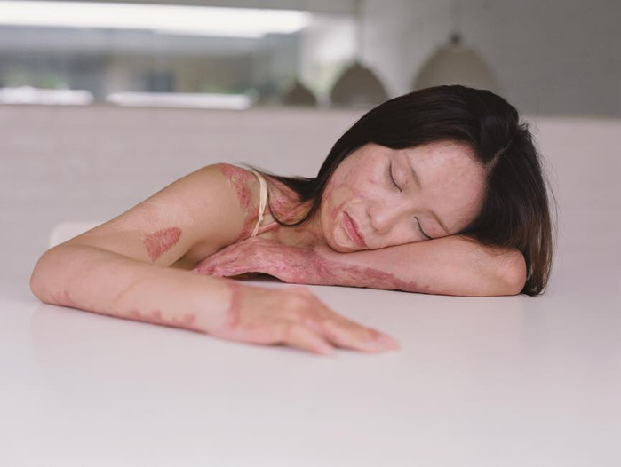 Cô gái bị thiêu sống năm 16 tuổi vì từ chối tình cảm của thiếu gia