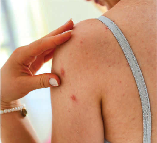 Đánh tan nỗi lo lưng mụn với các em bánh xà phòng chỉ dưới 40 ngàn