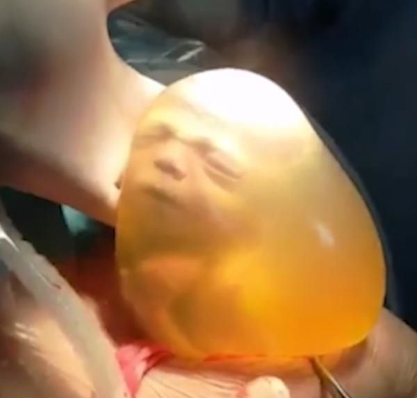 Chào đời trong bọc ối, em bé khiến CĐM thích thú vì chớp mắt mỉm cười