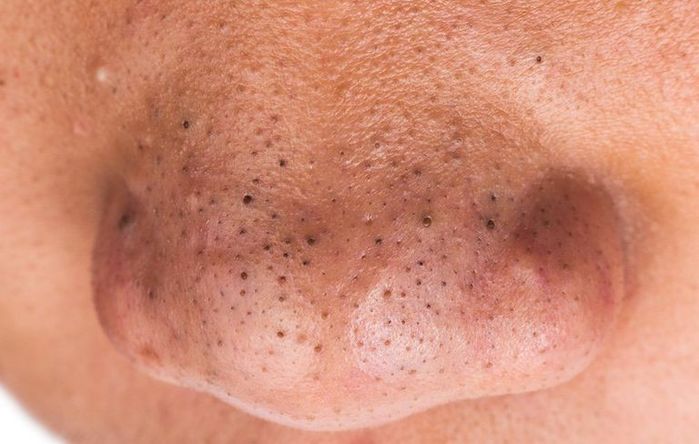 Hành động vô thức mà bạn thường làm gây hại không nhỏ cho sức khỏe