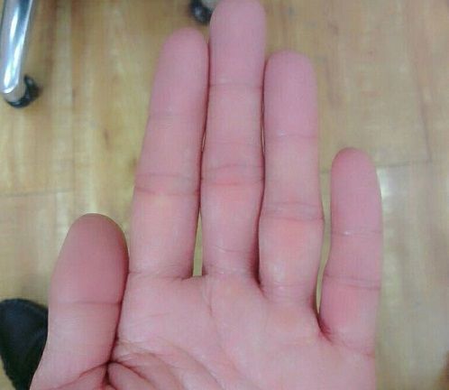 Nhìn kẽ hở ngón tay đoán biết ngay tương lai nghèo khó hay sang giàu