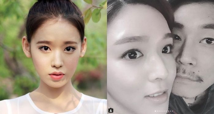 Sau Song - Song, đến y tá của Hậu duệ mặt trời tố chồng bạo hành