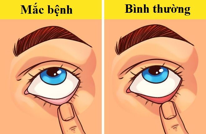 Chuyên gia chỉ cách chẩn đoán tiểu đường, tim mạch trong 1 phút
