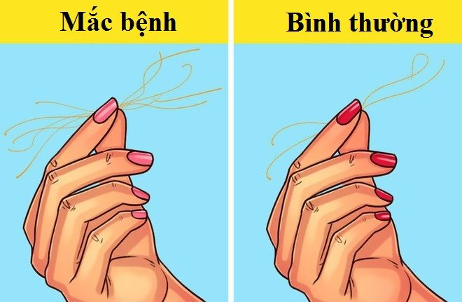 Chuyên gia chỉ cách chẩn đoán tiểu đường, tim mạch trong 1 phút