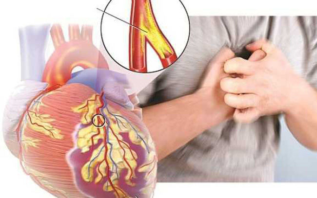 Cô đơn quá lâu dễ bị bệnh tim và trầm cảm gấp 3 lần bình thường