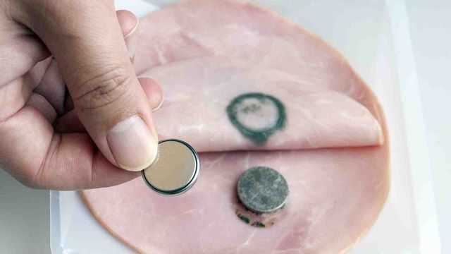 Em bé 2 tuổi suýt tử vong vì nuốt viên pin, bác sĩ gấp rút cấp cứu