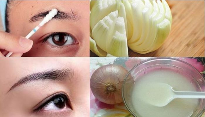 Chán cảnh lông mày nhợt nhạt dưỡng ngay với sữa tươi, nước ép hành tây
