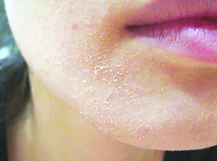 Da khô hay quá nhiều dầu là lúc bạn cần thay đổi quy trình skincare