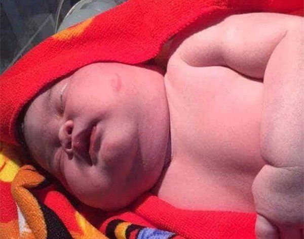 Em bé mới sinh cân nặng đến 6,8kg