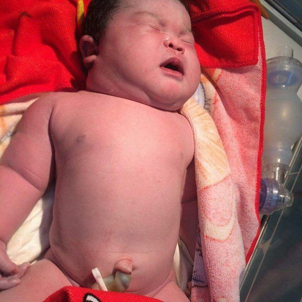 Em bé mới sinh cân nặng đến 6,8kg