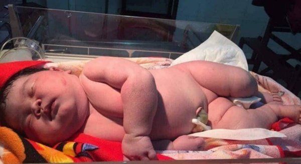 Em bé mới sinh cân nặng đến 6,8kg