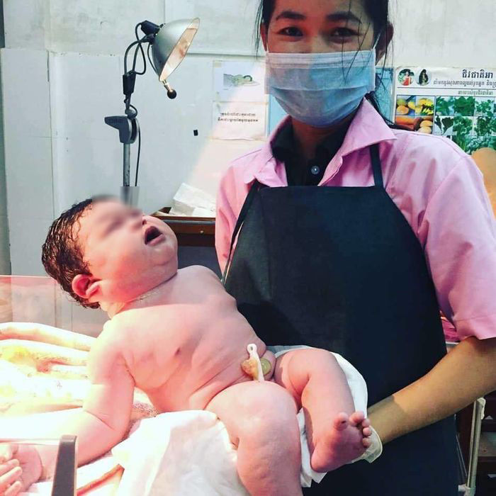 Em bé mới sinh cân nặng đến 6,8kg