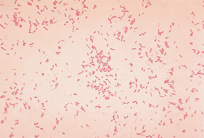 Khiếp sợ vì sự xâm lấn của vi khuẩn ăn thịt người, nhất là Clostridium