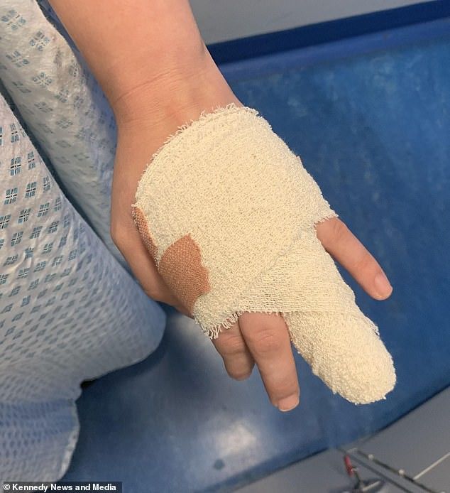 Cô gái bị nhiễm trùng suýt mất ngón tay vì thói quen sơn móng làm đẹp