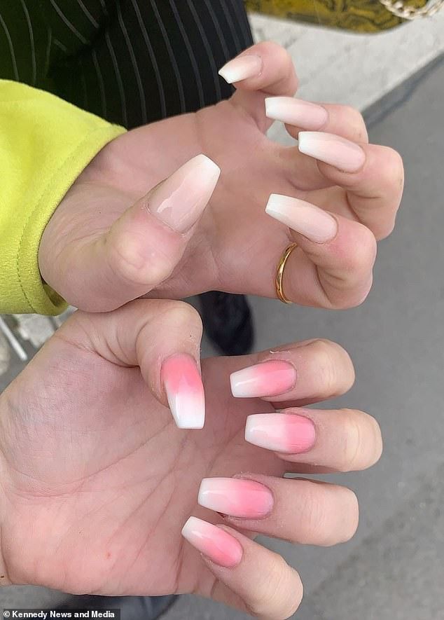 Cô gái bị nhiễm trùng suýt mất ngón tay vì thói quen sơn móng làm đẹp
