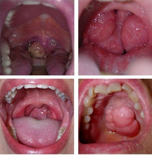 Mắc ung thư vòm họng, em trai Hứa Vĩ Văn qua đời để lại vợ và hai con