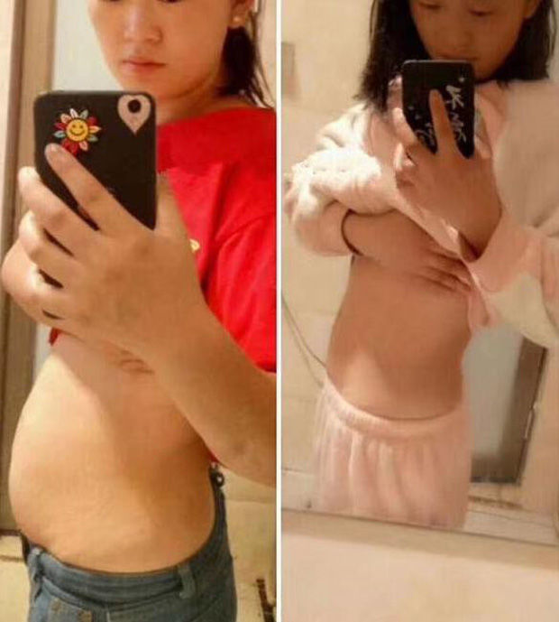 Bị đồng nghiệp chê bụng bự, cô gái giảm 6kg/tháng dù vẫn ăn 3 bữa/ngày