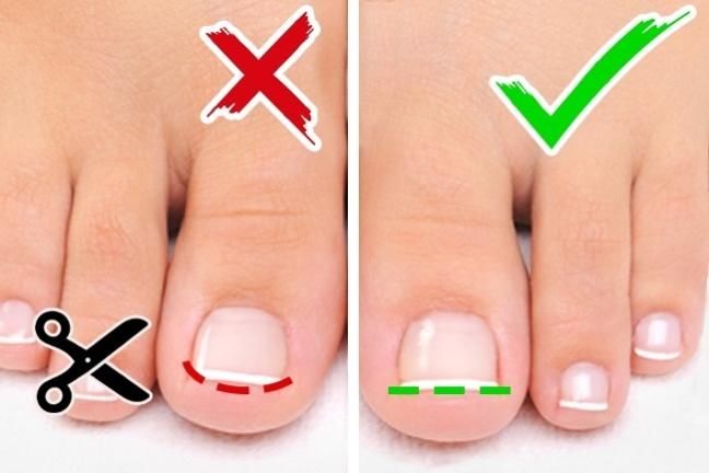 BS Masataka Saito Nhật: Cắt móng chân sai cách dễ nhiễm trùng huyết