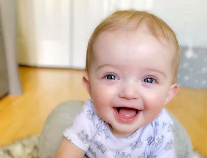 Em bé sở hữu vết sẹo lớn sau lưng vì chào đời hai lần