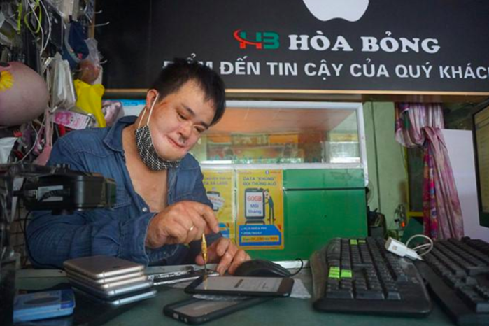 Bị bỏng 98%, chàng trai vẫn viết nên cổ tích với người vợ xinh đẹp
