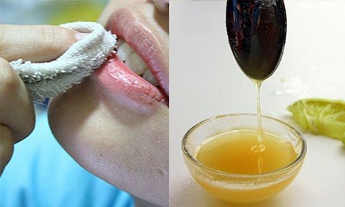 BS Da Liễu cảnh báo: Bôi son 3 lần/ngày có nguy cơ mắc lupus ban đỏ