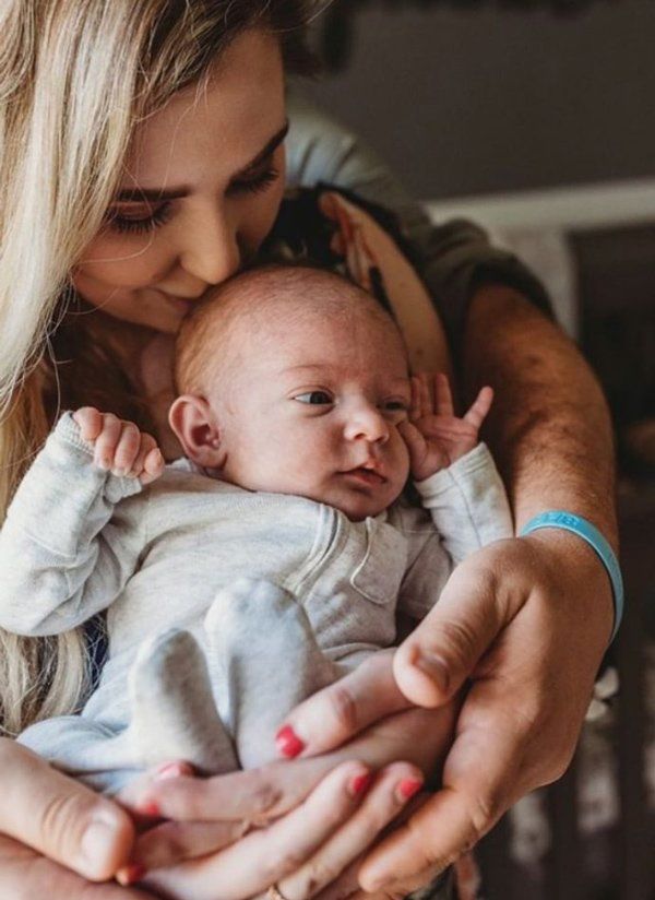 Em bé sở hữu vết sẹo lớn sau lưng vì chào đời hai lần