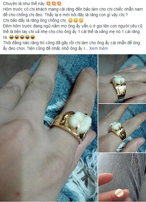 Lỡ vả chồng gãy răng, vợ làm luôn cho cái nhẫn mới để dằn mặt