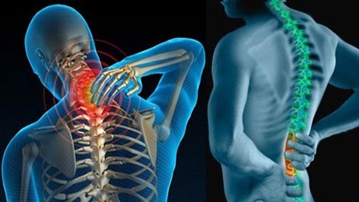 TS Rose Boucaut: Dùng điện thoại sai tư thế làm thoái hóa đốt sống cổ